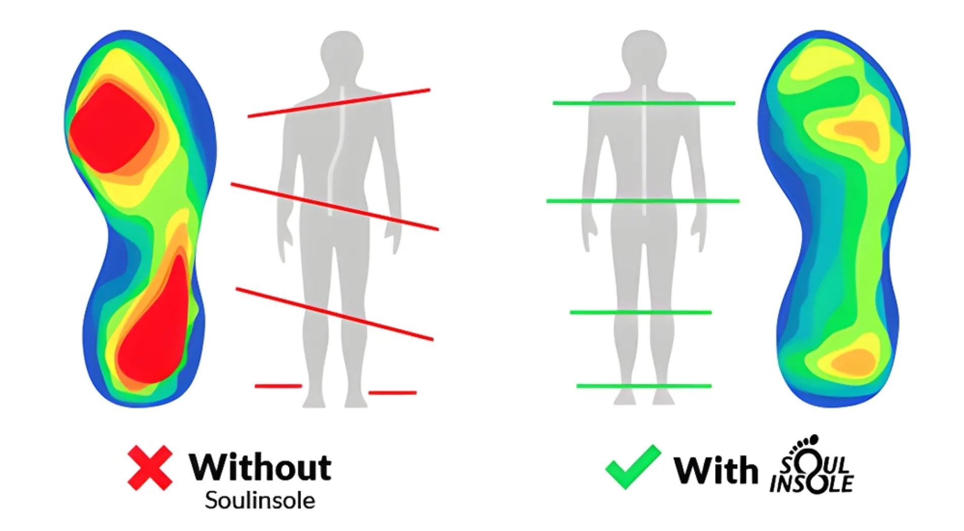 Soul Insole arch support inserts on a table